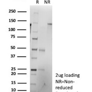 OLIG-2 Antibody in SDS-PAGE