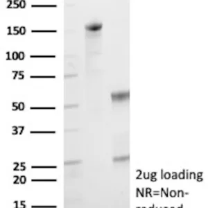 HK1 Antibody in SDS-PAGE