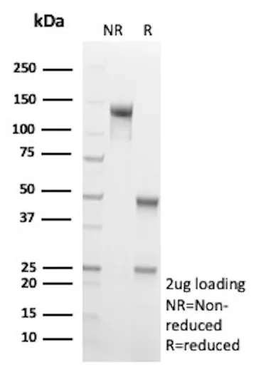 SDS-PAGE Analysis of Purified CD206 Mouse Monoclonal Antibody (MRC1/9463).
Confirmation of Purity and Integrity of Antibody. CD206 Antibody in SDS-PAGE