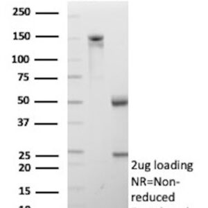 CD206 Antibody in SDS-PAGE