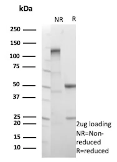 SDS-PAGE Analysis
Purified EGFL7 Mouse Monoclonal Antibody (EGFL7/9497).
Confirmation of Purity and Integrity of Antibody.
EGFL7 Antibody in SDS-PAGE