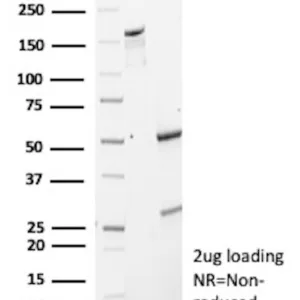 TSHR Antibody in SDS PAGE
