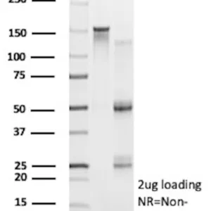 TSHR Antibody in SDS PAGE