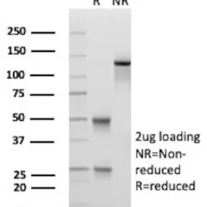 DNA/RNA Hybrid Antibody in SDS-PAGE
