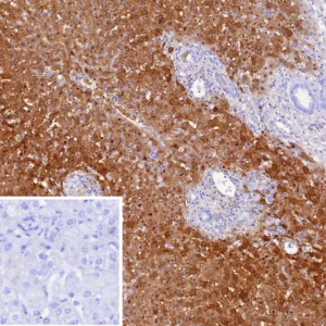 Arginase 1 Antibody in Immunohistochemistry (IHC (P))