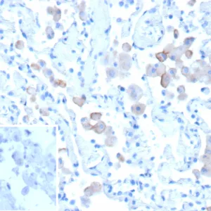 CD206 Antibody in Immunohistochemistry (IHC (P))