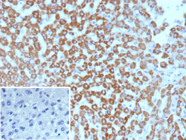 CPS1 Antibody in Immunohistochemistry (IHC (P))