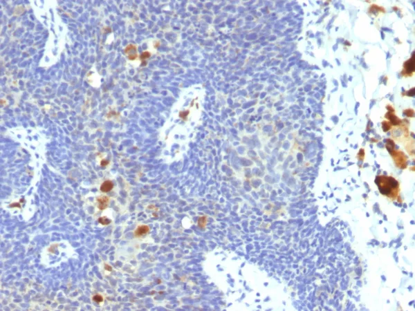 HPV16 E6 Antibody in Antibody in Immunohistochemistry (IHC (P))