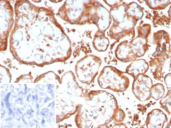 VEGF-A Antibody in Immunohistochemistry (IHC (P))