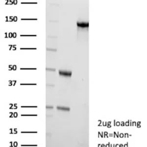 CETN1 Antibody in SDS-PAGE-1.jpg