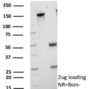 CETN1 Antibody in SDS-PAGE