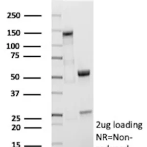 CFL2 Antibody in SDS-PAGE-1.jpg