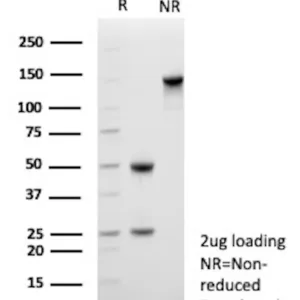 CD109 Antibody in SDS-PAGE