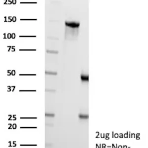 CPS1 Antibody in SDS-PAGE