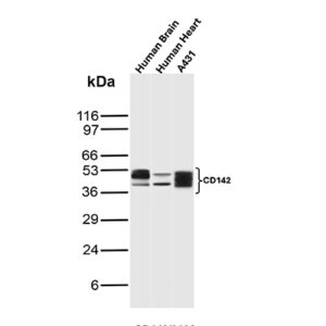 CD142 Antibody in Western Blot (WB)