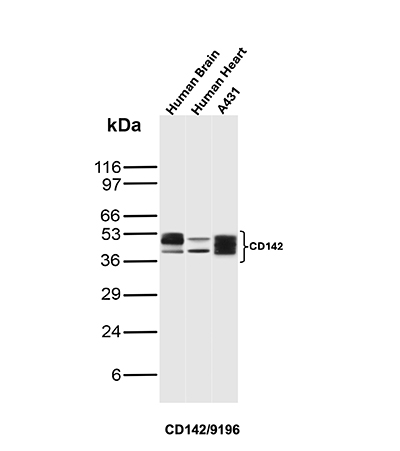 Western blot analysis of Human Brain, Human Heart and A431 lysates using CD142 Mouse Monoclonal
Antibody (CD142/9196). CD142 Antibody in Western Blot (WB)