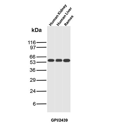 Western blot analysis of Human kidney, Human Liver and Ramos tissue lysates using Glucose 6-Phosphate Isomerase Mouse Monoclonal Antibody (GPI/2439). GPI Antibody in Western Blot (WB)