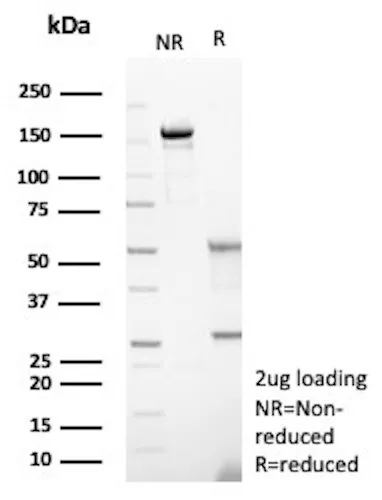 SDS-PAGE Analysis
Purified HK1 Mouse Monoclonal Antibody (HK1/9515).
Confirmation of Purity and Integrity of Antibody. HK1 Antibody in SDS-PAGE