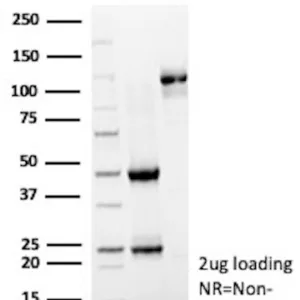 HK1 Antibody in SDS-PAGE