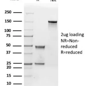 IGF-1R Antibody in SDS-PAGE