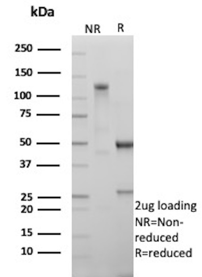 SDS-PAGE Analysis of PurifiedHH3 Recombinant Rabbit Monoclonal Antibody (HH3/13145R). Confirmation of Purity and Integrity of Antibody. Histone H3 (HH3) Antibody in SDS-PAGE