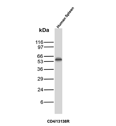 Western Blot Analysis of human spleen tissue lysate using CD4 Recombinant Rabbit Monoclonal Antibody (CD4/13138R). CD4 Antibody in Western Blot (WB)