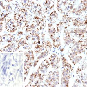 Transcription factor A, mitochondrial (TFAM) Antibody in Immunohistochemistry (IHC (P))