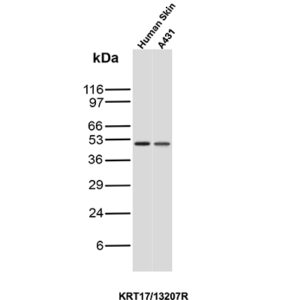 Cytokeratin 17 Antibody in Western Blot (WB)