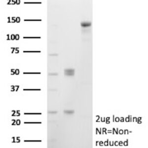 SMTN Antibody in SDS-PAGE