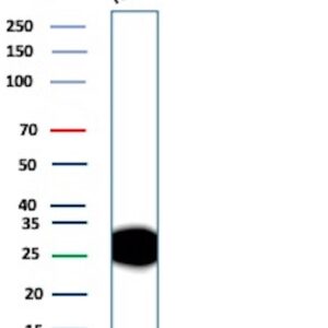 Adiponectin Antibody in Western Blot (WB)