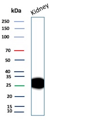 Western Blot Analysis of Human Kidney tissue lysate using ADPN Recombinant Rabbit Monoclonal Antibody (ADPN/13060R). Adiponectin Antibody in Western Blot (WB)