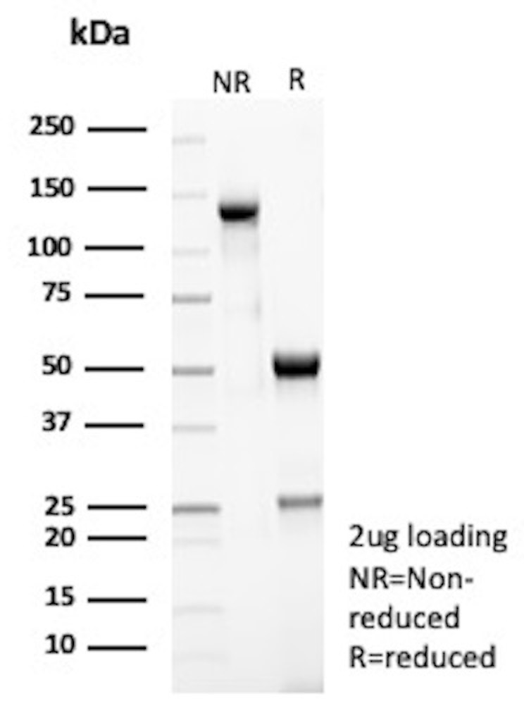 SDS-PAGE Analysis
Purified Peroxiedoxin 4 Mouse Monoclonal Antibody CPTC-PRDX4-1).
Confirmation of Purity and Integrity of Antibody.
Peroxiredoxin 4 Antibody in SDS-PAGE