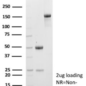 MSM4 Antibody in SDS-PAGE