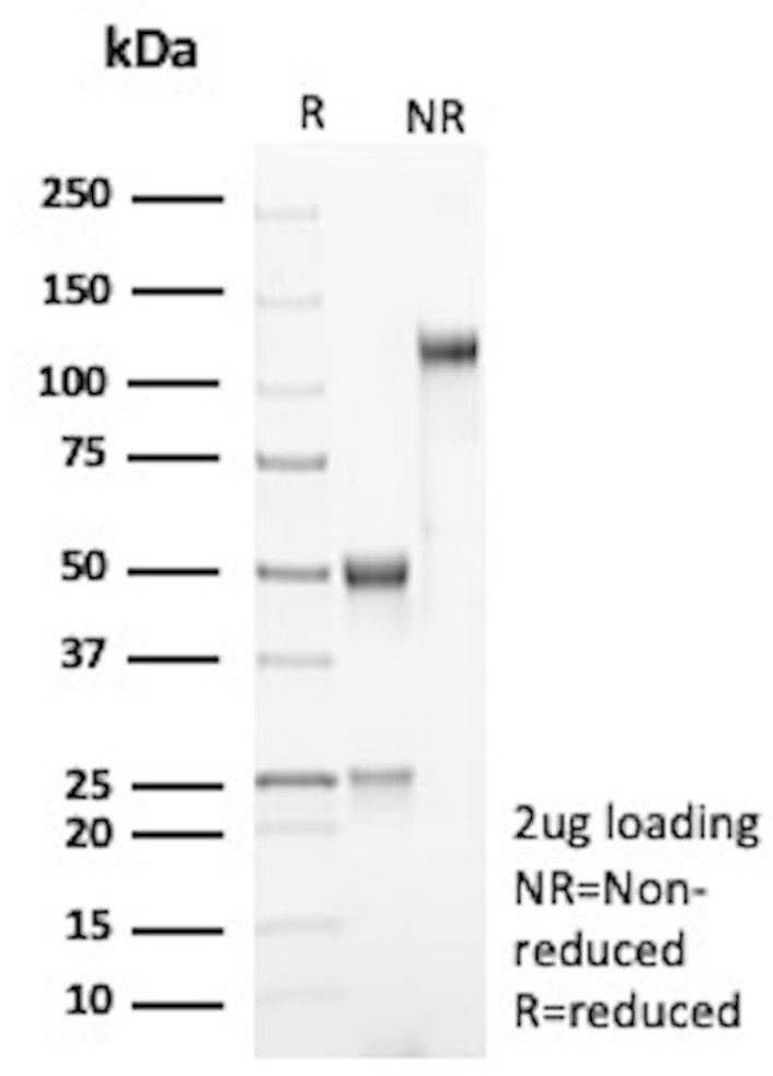 SDS-PAGE Analysis
Purified PDL2 Mouse Monoclonal Antibody (PDL2/2681).
Confirmation of Purity and Integrity of Antibody.
PDL2 Antibody in SDS-PAGE