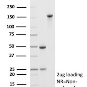 ABCC4 Antibody in SDS-PAGE