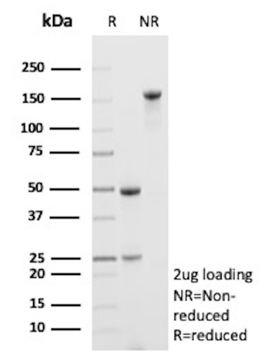 SDS-PAGE Analysis of Purified ABCC4 Mouse Monoclonal Antibody (ABCC4/9180).
Confirmation of Purity and Integrity of Antibody. ABCC4 Antibody in SDS-PAGE