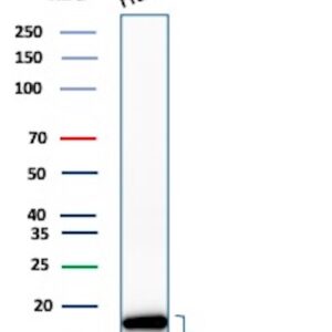 P16INK4a Antibody in Western Blot (WB)