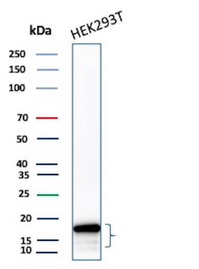 Western Blot Analysis of HEK293T cell lysate using P16INK4a Recombinant Rabbit Monoclonal Antibody (CDKN2A/13158R). P16INK4a Antibody in Western Blot (WB)