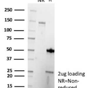 Il7 Antibody in SDS-PAGE