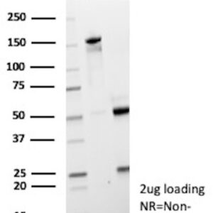 CD171 Antibody in SDS-PAGE