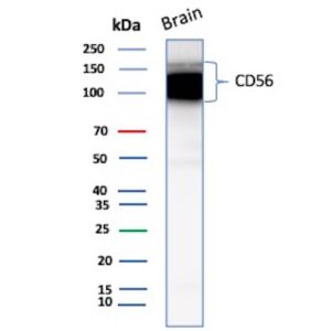 CD56 Antibody in Western Blot (WB)