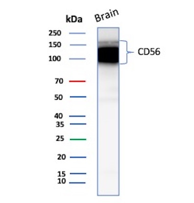 Western Blot Analysis of Human Brain tissue lysate using CD56 Recombinant Rabbit Monoclonal Antibody (NCAM1/13259R). CD56 Antibody in Western Blot (WB)
