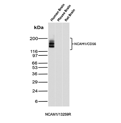Western Blot Analysis of Human Brain, Mouse Brain and Rat Brain tissue lysates using CD56 Recombinant Rabbit Monoclonal Antibody (NCAM1/13259R). CD56 Antibody in Western Blot (WB)