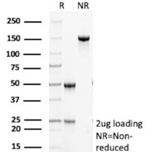 VEGF-A Antibody in SDS-PAGE