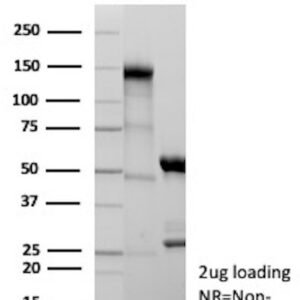 E-Cadherin (CDH1) Antibody in SDS-PAGE