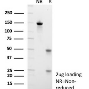 MUC13 Antibody in SDS-PAGE