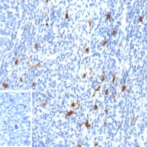 Formalin-fixed, paraffin-embedded human tonsil stained with CD83 Recombinant Mouse Monoclonal Antibody (r1H4b). Inset: PBS instead of primary antibody; secondary only negative control. CD83 Antibody in Immunohistochemistry (IHC (P))