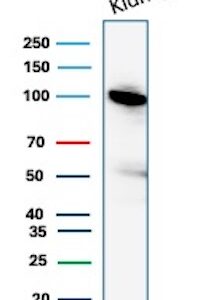 CD10 Antibody in Western Blot (WB)