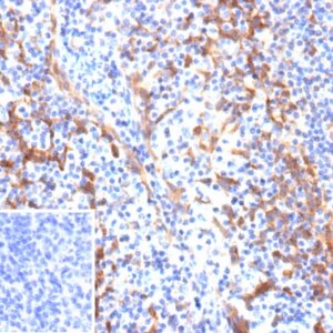 ALCAM / CD166 Antibody in Immunohistochemistry (IHC (P))