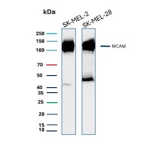 CD146 / MUC18 / MCAM Antibody in Western Blot (WB)